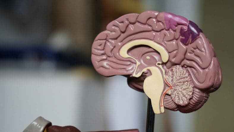 cut open brain diagram