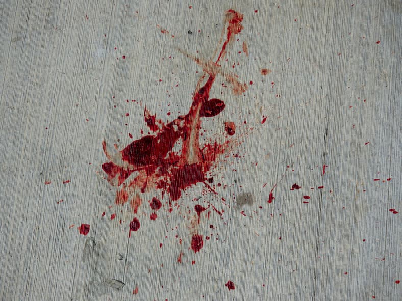 blood smeared on table