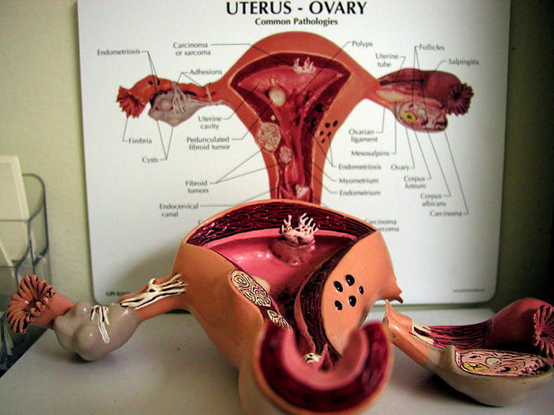 uterus diagram