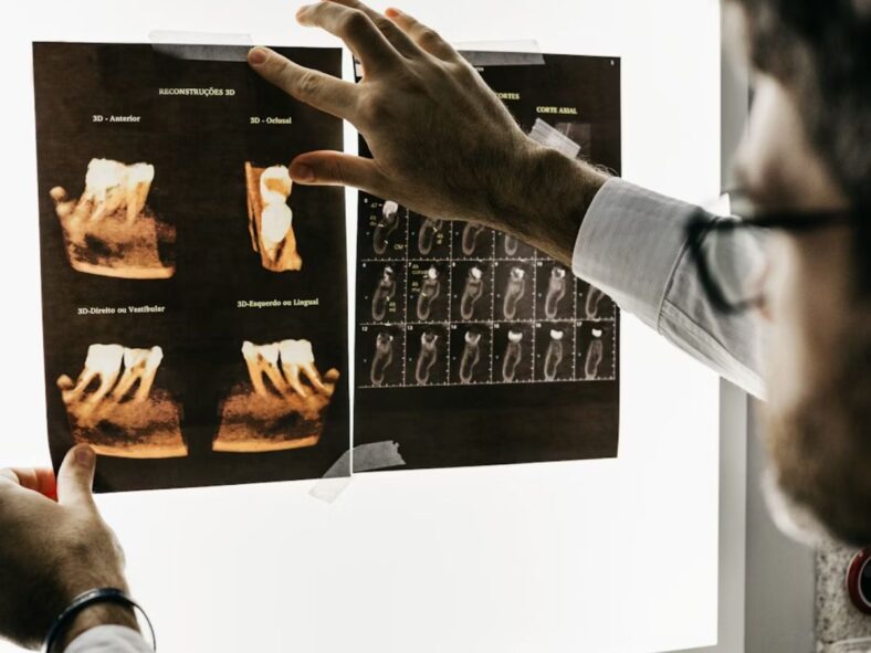 x-ray Unsplash